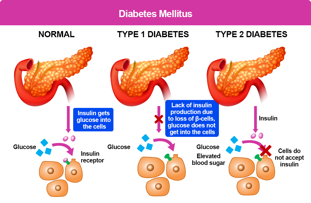 Searching for latest cure of diabetes? Contact Neem Nutraceuticals for 100% cure +254720760419